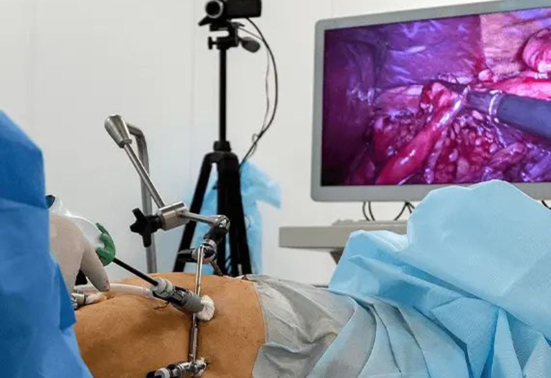 General and Laparoscopic Surgery